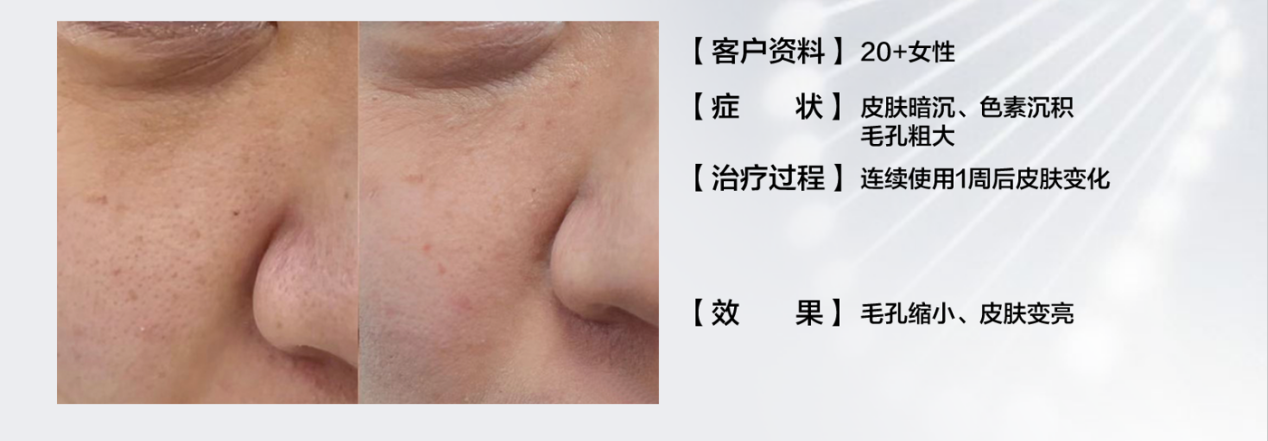 科普：细胞外囊泡：治疗皮肤老化和美白的天然疗法