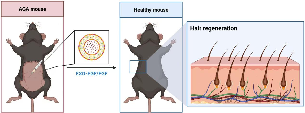 志恒生物双因子工程化外泌体治疗雄激素性脱发获验证。